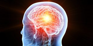 Brain Cancer Linked To Tissue Healing: Researchers brain cancer