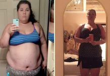 The Truth About Weight Regain After Gastric Sleeve Surgery