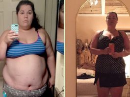 The Truth About Weight Regain After Gastric Sleeve Surgery